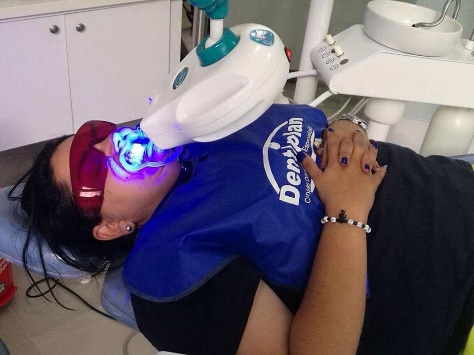 blanqueamiento dental laser